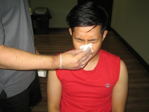 A nosebleed, also known as epistaxis, can occur whenever a blood vessel in any one of the nasal linings bursts. 